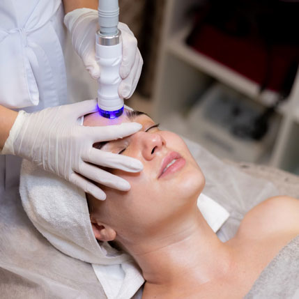 Erbium Laser in London